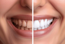 why-choose-antalya-for-teeth-whitening?-benefits,-costs,-and-results