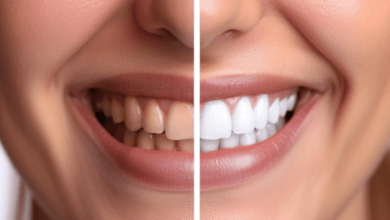 why-choose-antalya-for-teeth-whitening?-benefits,-costs,-and-results